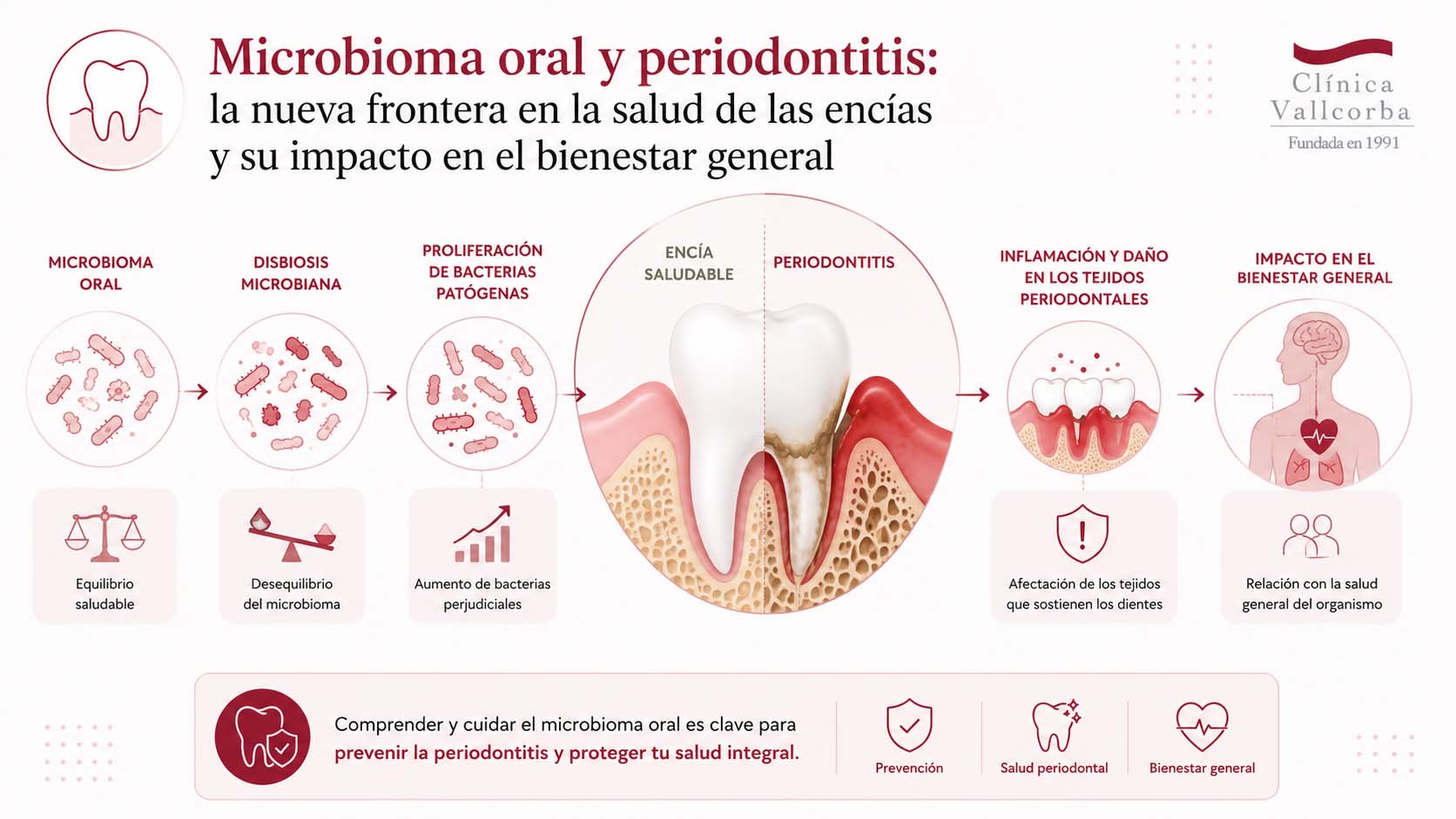 de cada paciente | Microbioma oral y periodontitis la nueva frontera en la salud de las encias