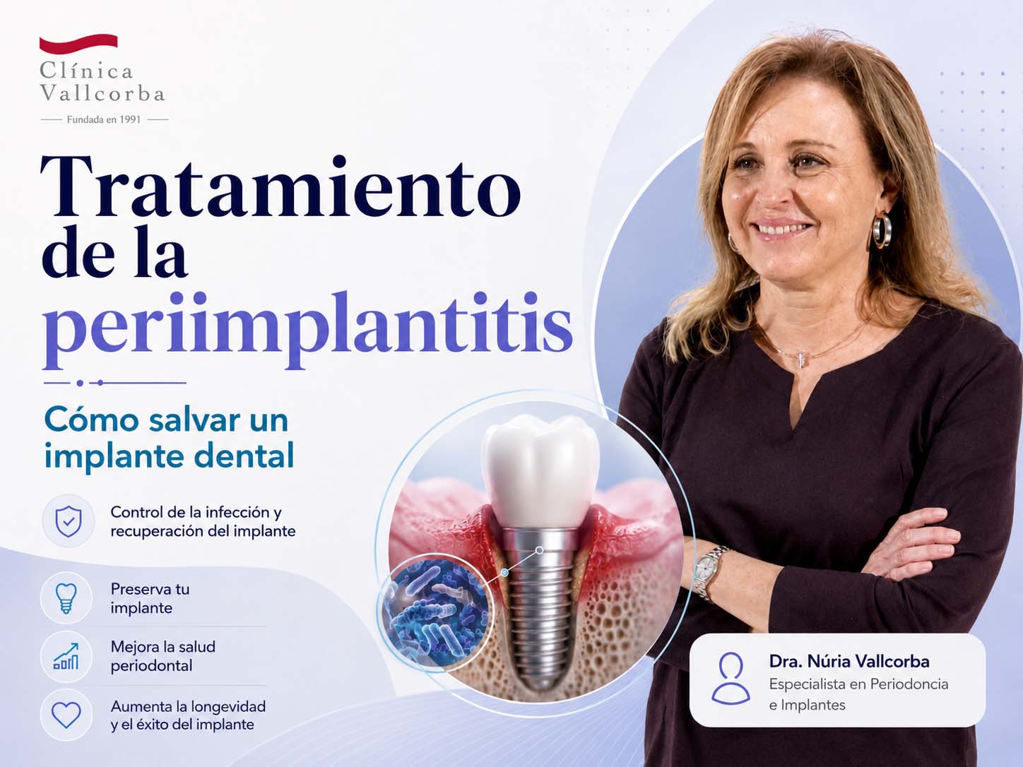 clinica vallcorba dentistas en barcelona expertos con tratamientos dentales personalizados para problemas bucodentales | Tratamiento de la periimplantitis como salvar un implante dental