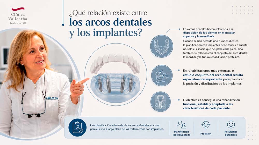 infografia de clinica vallcorba sobre la relacion que existe entre los arcos dentales y los implantes