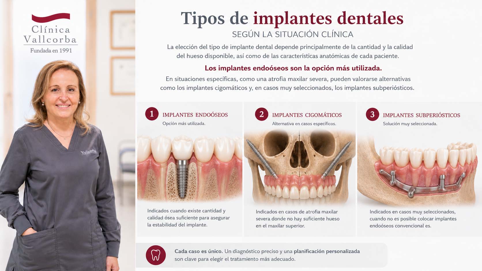 implantes subperiósticos | Tipos de implantes dentales cual es el mas adecuado para cada paciente
