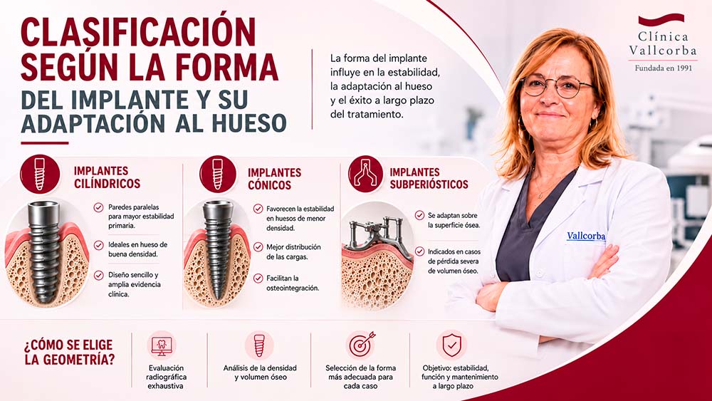 como se elige la geometría del implante | Tipos de implantes dentales segun su diseño conexion y superficie