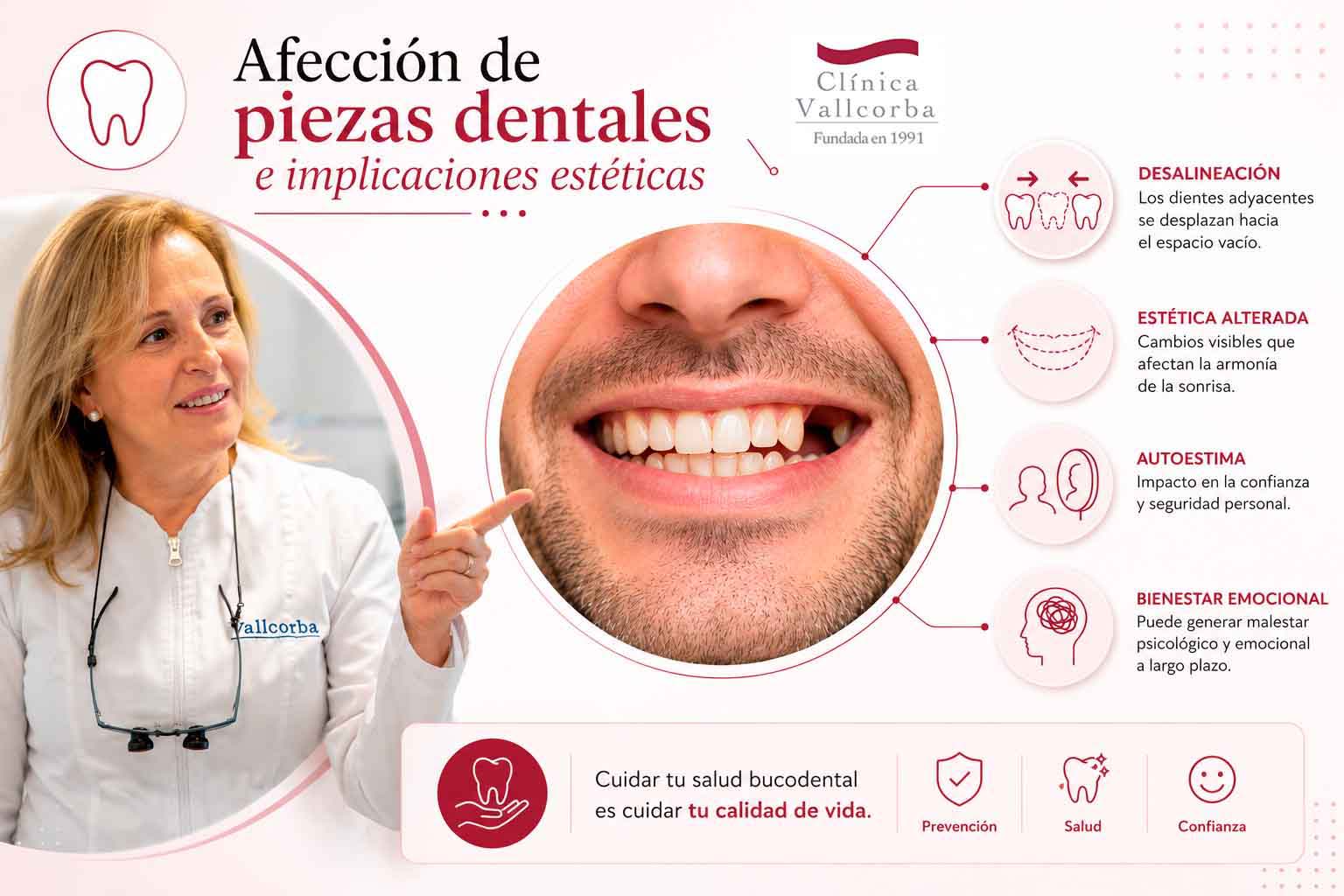 Afeccion de piezas dentales e implicaciones esteticas | Por que vuelve la periodontitis despues del tratamiento