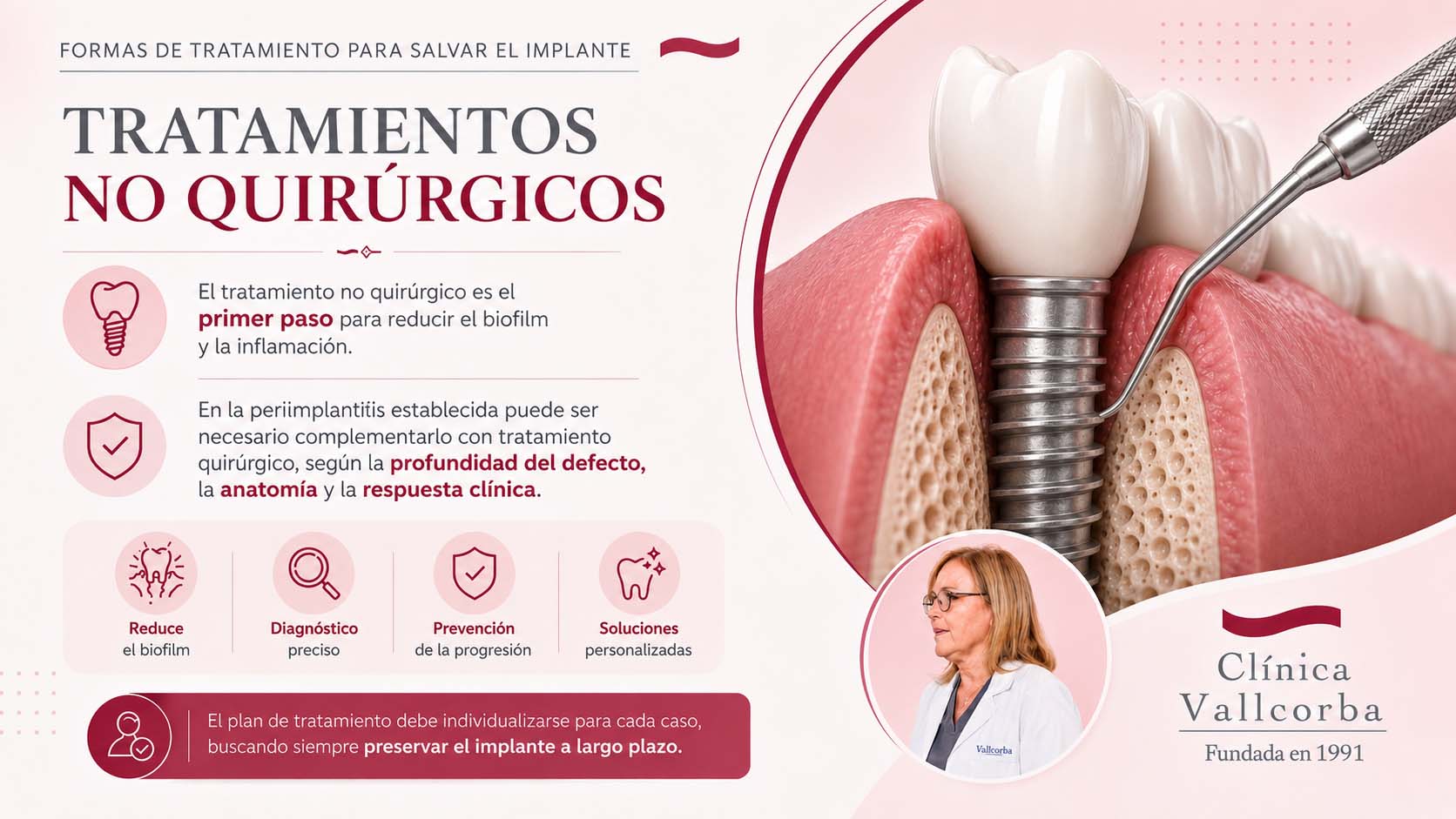 Tratamientos no quirúrgicos en clinica dental comte durgell por expertos en periodoncia barcelona |  descubre los tratamientos de periodoncia en el eixample | Tratamiento de la periimplantitis como salvar un implante dental