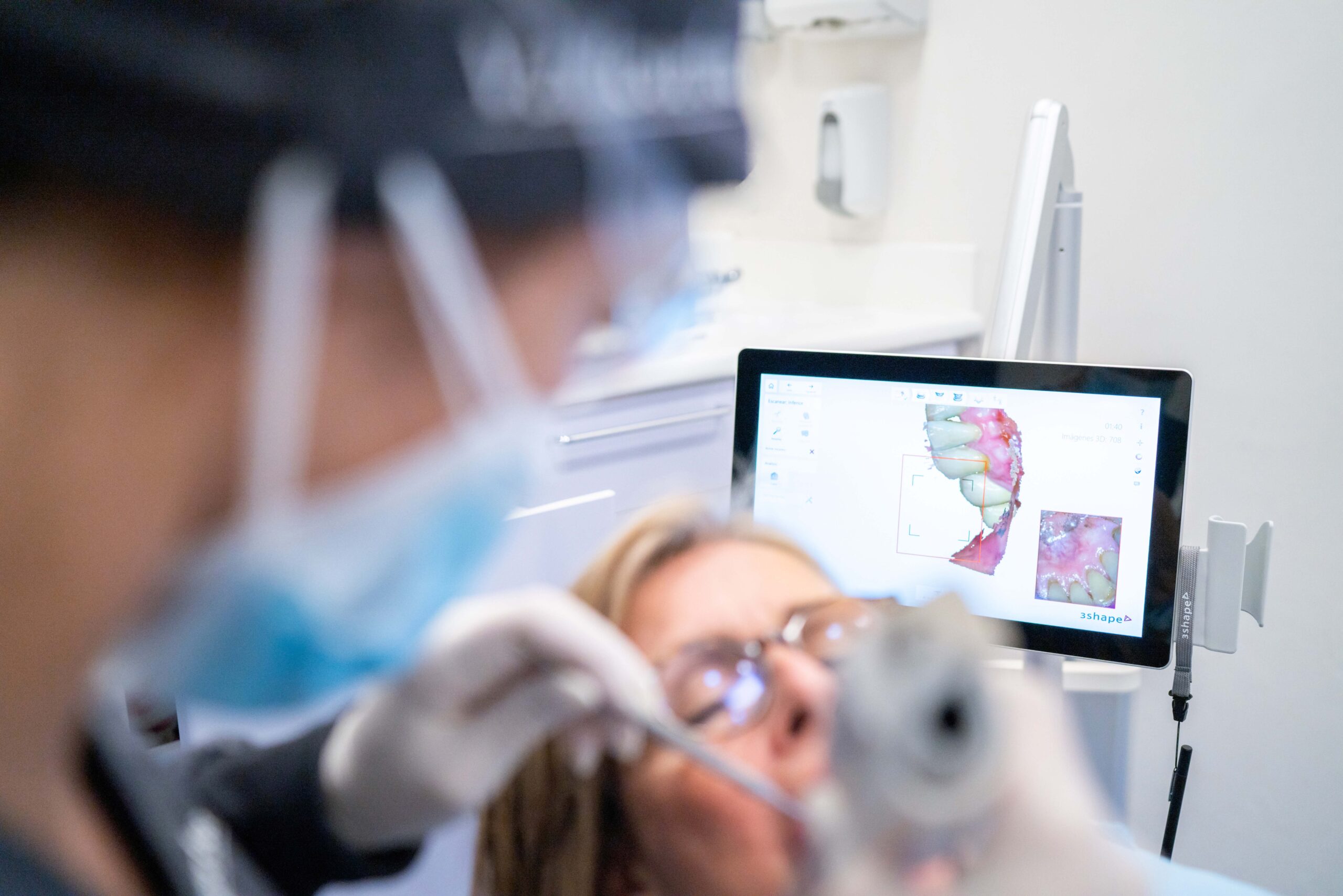 Escáner intraoral y planificación virtual de la sonrisa Escaneos rápidos capturan la morfología bucal digitalmente para planificar el resultado protésico previsto | Implantes dentales precio y factores que influyen en el coste del tratamiento Escáner intraoral y planificación virtual de la sonrisa Escaneos rápidos capturan la morfología bucal digitalmente para planificar el resultado protésico previsto | Implantes dentales precio y factores que influyen en el coste del tratamiento