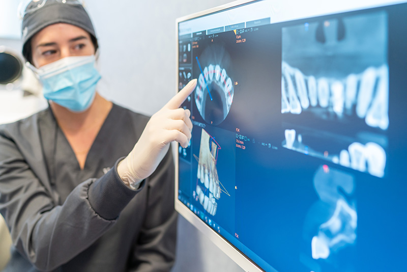 la planificacion digital | Tipos de implantes dentales segun su diseño conexion y superficie