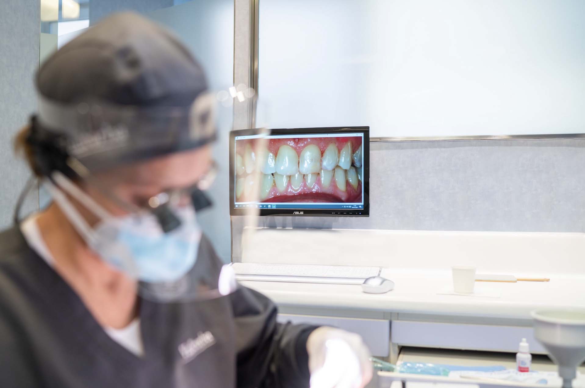 inflamacion de encias dentista barcelona | inflamacion de encias