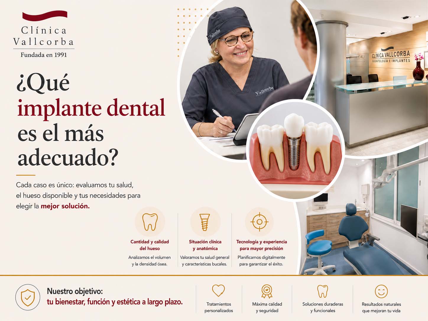 como saber que tipo de implante necesito | dentistas buenos en barcelona expertos en periodoncia barcelona | ven a nuestra clinica dental comte d'urgell y conoce nuestros servicios de periodoncia en el eixample | Tipos de implantes dentales cual es el mas adecuado para cada paciente
