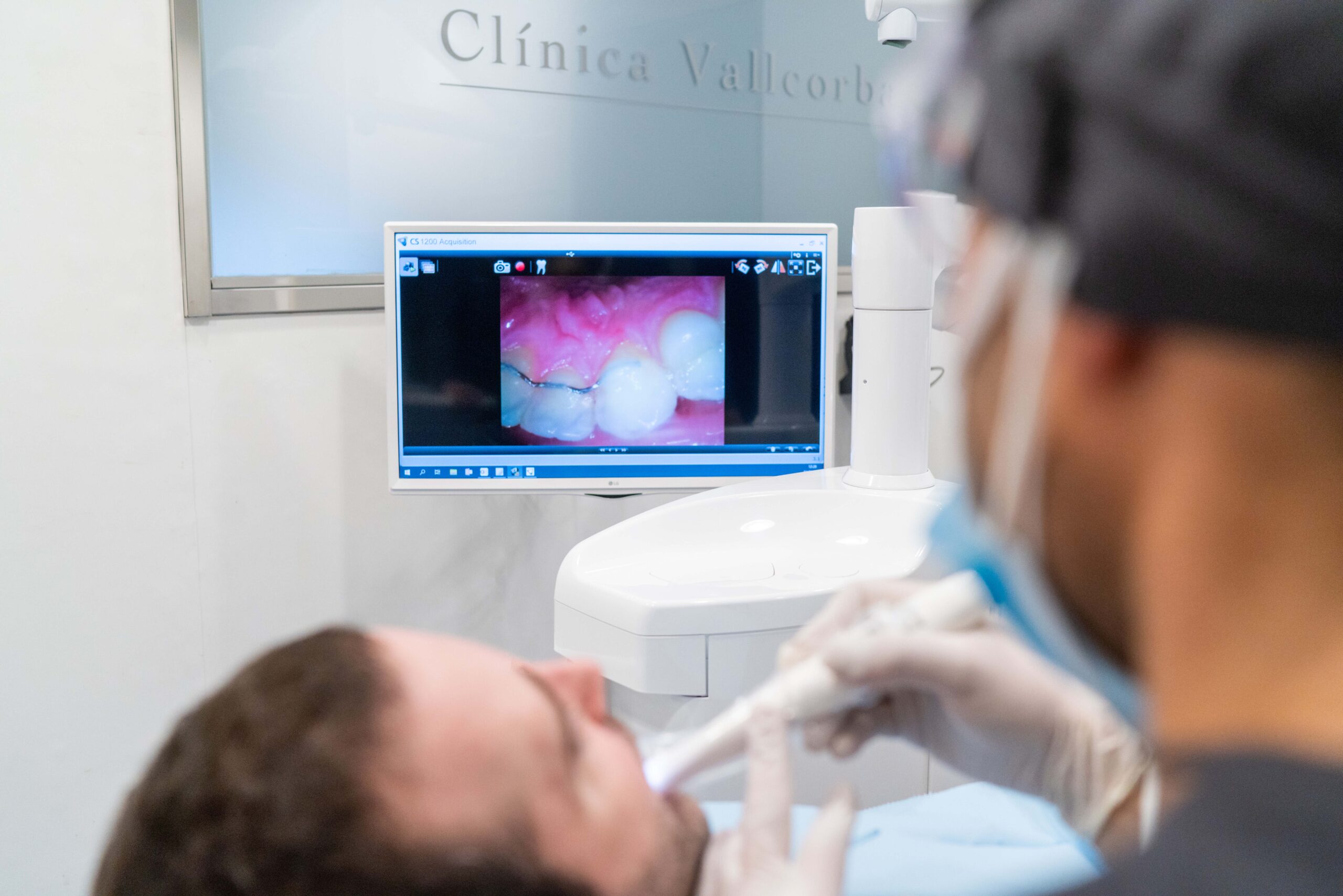 pérdida ósea severa y recuperacion de la sonrisa en clinica dental en el eixample | Implantes dentales cuando hay poco hueso opciones de tratamiento