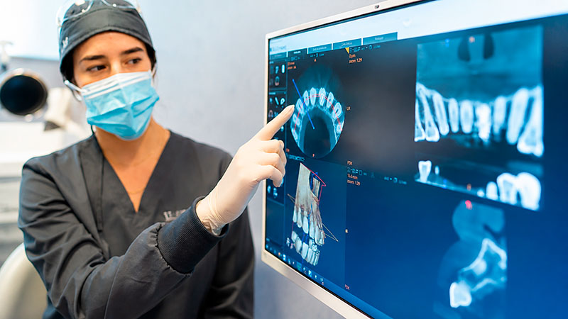 seguimiento profesional y control radiografico | cuanto dura un implante dental
