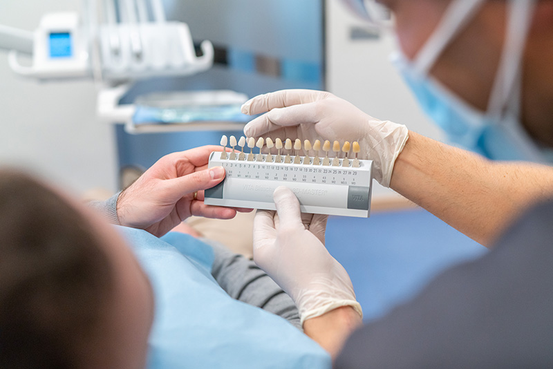 carillas dentales en barcelona | arcos implantes dentales