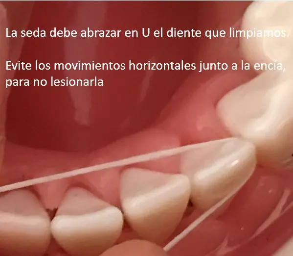 Usar seda dental es fundamental para una buena salud bucodental
