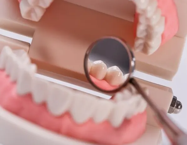 ¿Cuánto cuesta un tratamiento con implantes dentales?