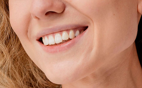 La importancia del control de los implantes dentales