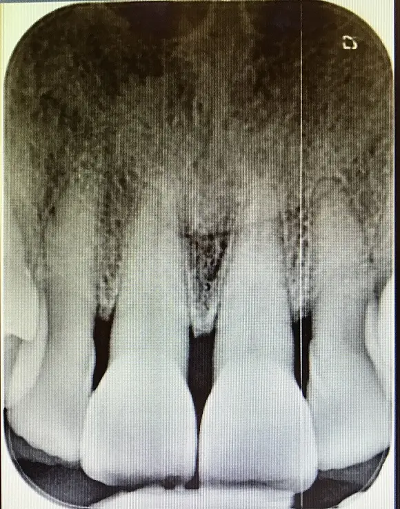 ¿Para qué realizamos radiografías los dentistas?