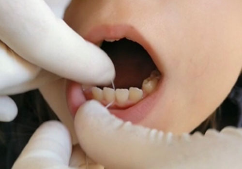 Tipos de hilo dental