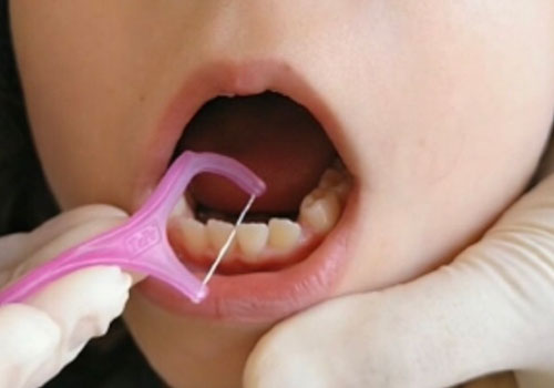 Tipos de hilo dental